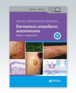 Dermatosis ampollares autoinmunes: Haga su diagnóstico – 2022