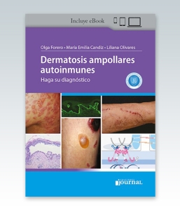 Dermatosis ampollares autoinmunes: Haga su diagnóstico – 2022