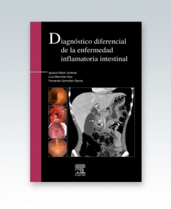 Diagnóstico diferencial de la enfermedad inflamatoria intestinal . Edición 2012