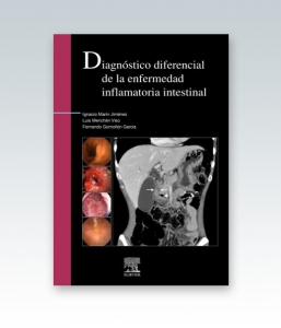 Diagnóstico diferencial de la enfermedad inflamatoria intestinal . Edición 2012
