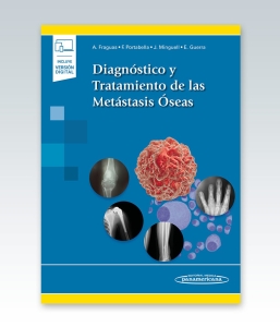 Diagnóstico y Tratamiento de las Metástasis Óseas. 1ª Edición – 2021