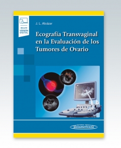 Ecografía Transvaginal en la Evaluación de los Tumores de Ovario (incluye versión digital)