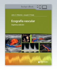 Ecografía Vascular. 7ª Edición – 2021