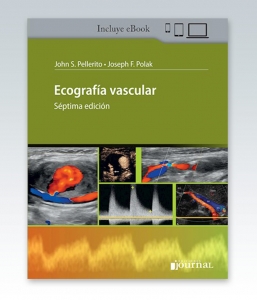 Ecografía Vascular. 7ª Edición – 2021