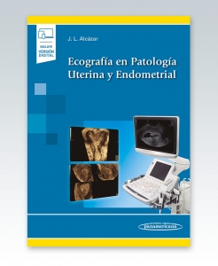 Ecografía en Patología Uterina y Endometrial. Incluye Ebook – 2021