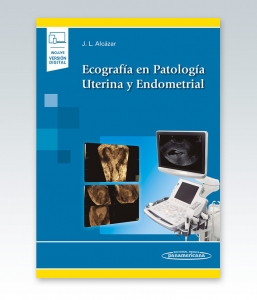 Ecografía en Patología Uterina y Endometrial. Incluye Ebook – 2021