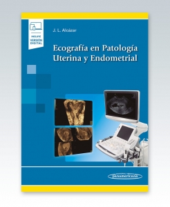 Ecografía en Patología Uterina y Endometrial. 1ª Edición – 2021