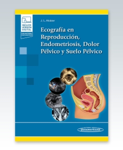 Ecografía en Reproducción, Endometriosis, Dolor Pélvico y Suelo Pélvico. 1ª Edición – 2022