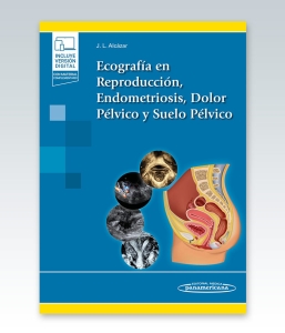 Ecografía en Reproducción, Endometriosis, Dolor Pélvico y Suelo Pélvico. 1ª Edición – 2022