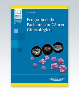 Ecografía en la Paciente con Cáncer Ginecológico. 1ª Edición – 2022