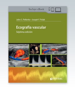 Ecografía vascular. 7ª Edición – 2021