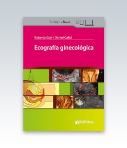 Ecografía Ginecológica. 2ª Edición – 2023