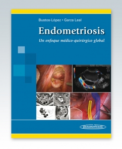 Endometriosis. Un enfoque médico-quirúrgico global. Edición 2013. Bustos