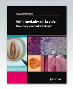 Enfermedades de la vulva. Un enfoque interdisciplinario – 2018