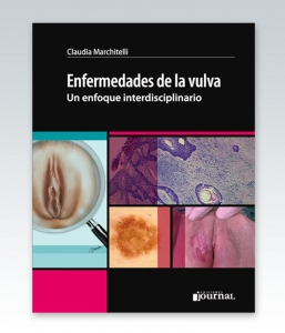 Enfermedades de la vulva. Un enfoque interdisciplinario – 2018