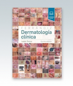 Ferrándiz. Dermatología clínica. 5ª Edición – 2019