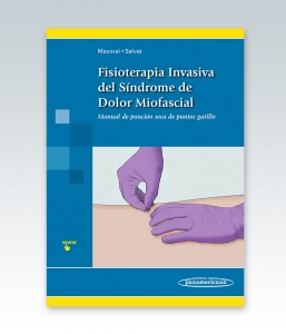 Fisioterapia Invasiva del Síndrome de Dolor Miofascial Manual de punción seca de puntos gatillo