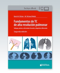 Fundamentos de TC de alta resolución pulmonar. 2ª Edición – 2021