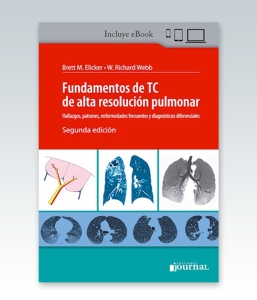 Fundamentos de TC de alta resolución pulmonar. 2ª Edición – 2021