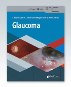 Glaucoma. 1ª Edición – 2021