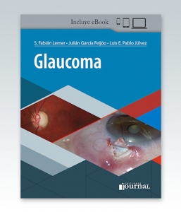 Glaucoma. 1ª Edición – 2021