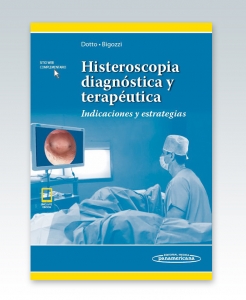 Histeroscopia diagnóstica y terapéutica (incluye versión digital). Indicaciones y estrategias