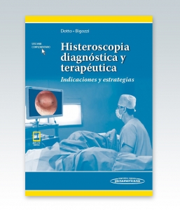 Histeroscopia diagnóstica y terapéutica (incluye versión digital). Indicaciones y estrategias