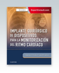 Implante quirúrgico de dispositivos para la monitorización del ritmo cardíaco + ExpertConsult.