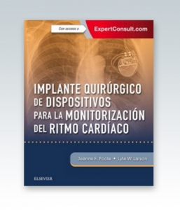 Implante quirúrgico de dispositivos para la monitorización del ritmo cardíaco + ExpertConsult.