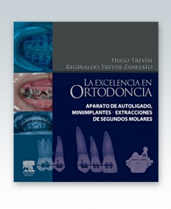 La excelencia en ortodoncia. Aparato de autoligado, miniimplantes y extracc. 2012