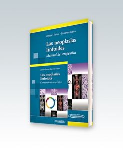 Las neoplasias linfoides Manual de terapéutica + Compendio de terapéutica