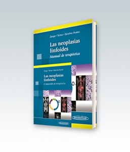 Las neoplasias linfoides Manual de terapéutica + Compendio de terapéutica