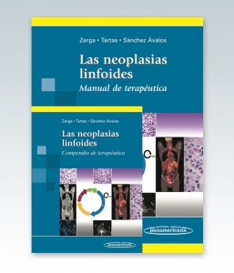 Las neoplasias linfoides Manual de terapéutica + Compendio de terapéutica