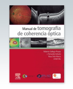 Manual de tomografía de coherencia óptica – 2021