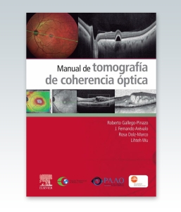 Manual de tomografía de coherencia óptica – 2021