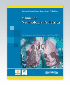 Manual de Neumología Pediátrica. Soc. Española de Neumología Pediátrica