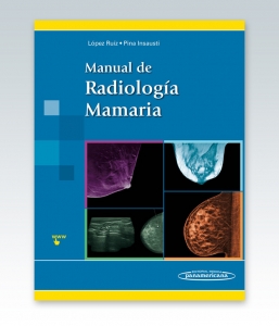 Manual de Radiología Mamaria. López Ruiz – Pina Insausti. 2016