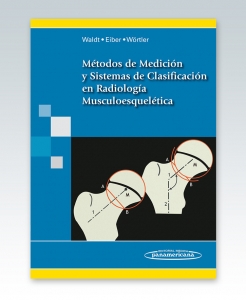 Métodos de Medición y Sistemas de Clasificación en Radiología Musculoesquelética