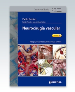 Neurocirugía vascular – 2021