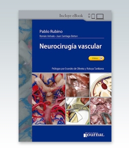 Neurocirugía vascular – 2021