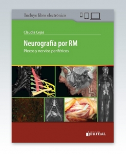 Neurografía por RM – 2020