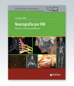 Neurografía por RM – 2020