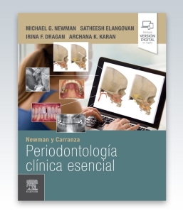 Newman y Carranza. Periodontología clínica esencial. 1ª Edición – 2023