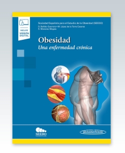 Obesidad. Una enfermedad crónica. 1ª Edición – 2022