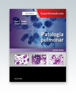 Patología pulmonar + ExpertConsult. 2ª Edición