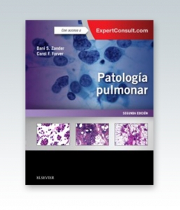 Patología pulmonar + ExpertConsult. 2ª Edición