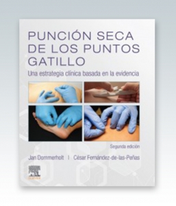 Punción seca de los puntos gatillo. 2ª Edición – 2019