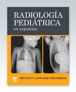 Radiología pediátrica en urgencias – 2022