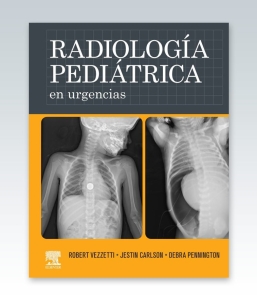 Radiología pediátrica en urgencias – 2022