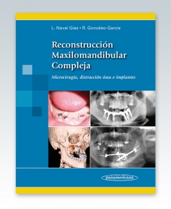 Reconstrucción Maxilomandibular Compleja Microcirugía. Edición 2013. Naval